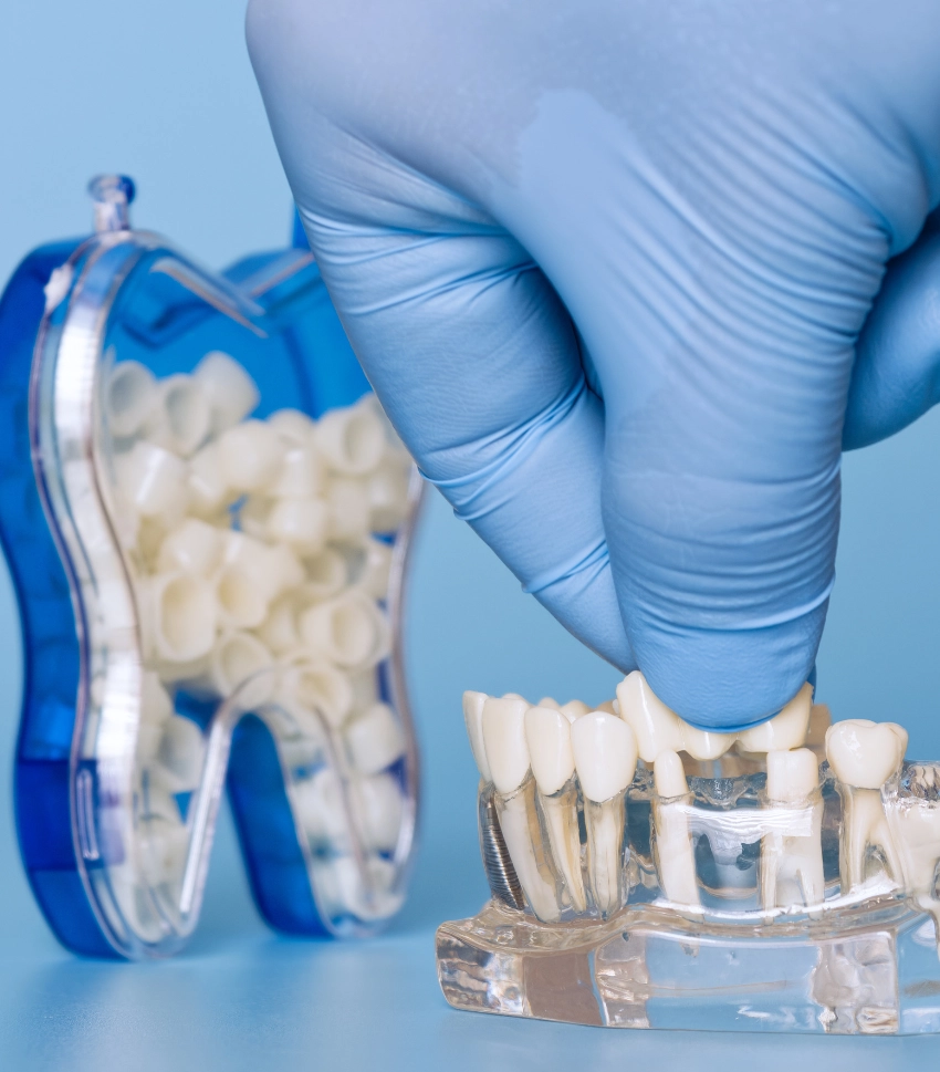 Dental Prosthodontics - test