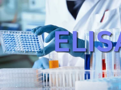 Fundamental laboratory techniques -ELISA