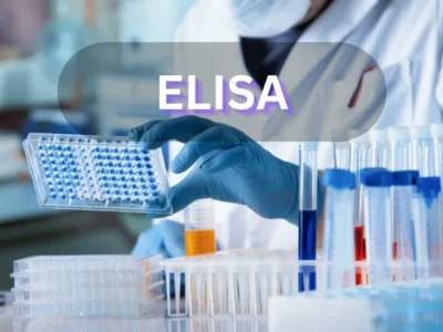 Fundamental laboratory techniques -ELISA